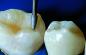 Preview: Intensiv FG Composhape Set A&P, REF 018